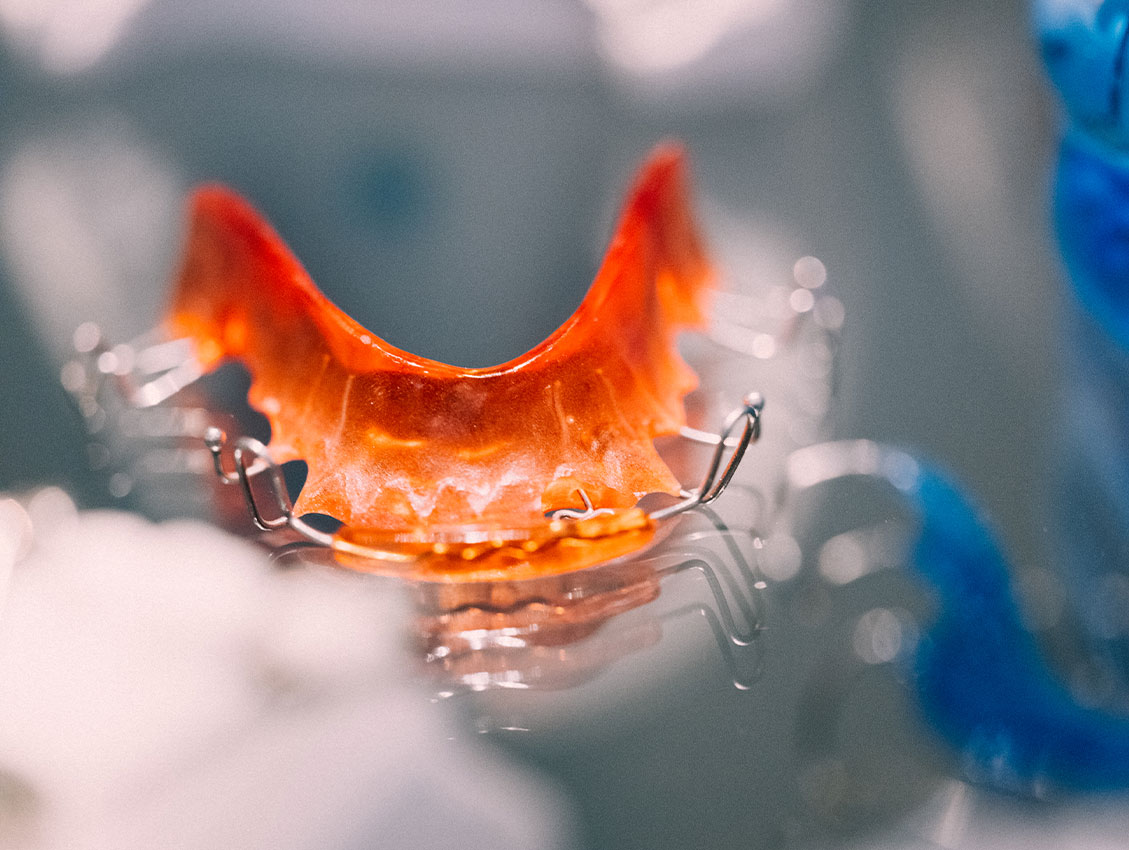 Kieferorthopädie Deggendorf – Nahaufnahme einer individuell gefertigten, herausnehmbaren Zahnspange in kräftigem Orange – moderne Kieferorthopädie mit Persönlichkeit bei ARTPRAXIS® Deggendorf.